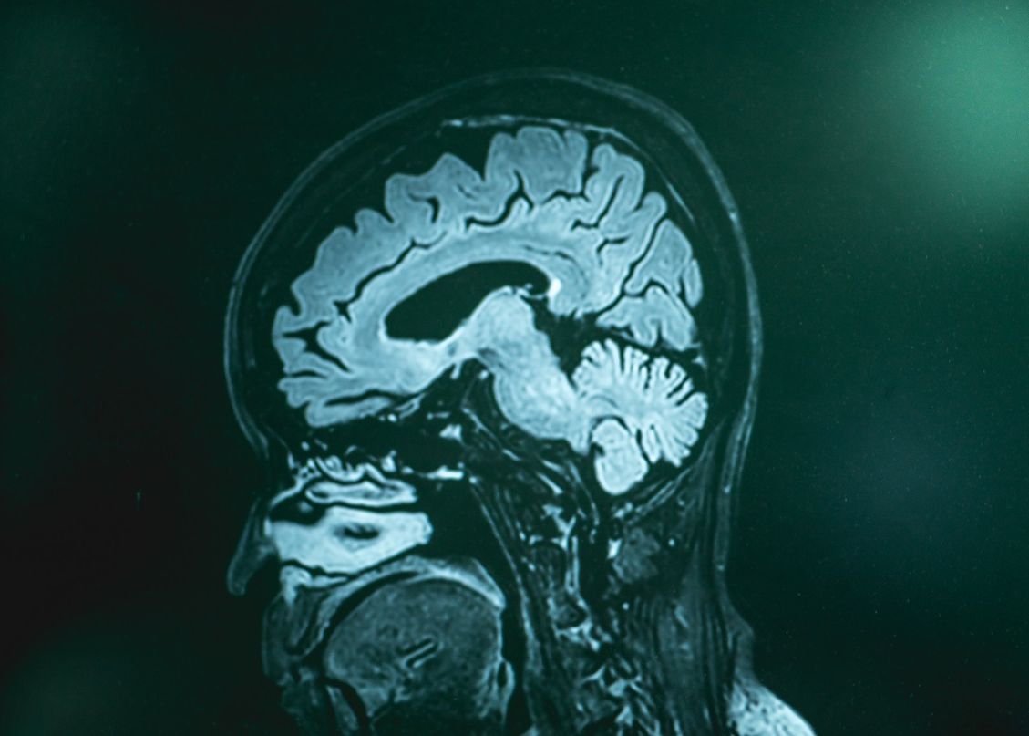 Legatura Nestiuta Dintre Calitatea Aerului Respirat Si Riscul De A Dezvolta Dementa Un Nou Studiu Lanseaza