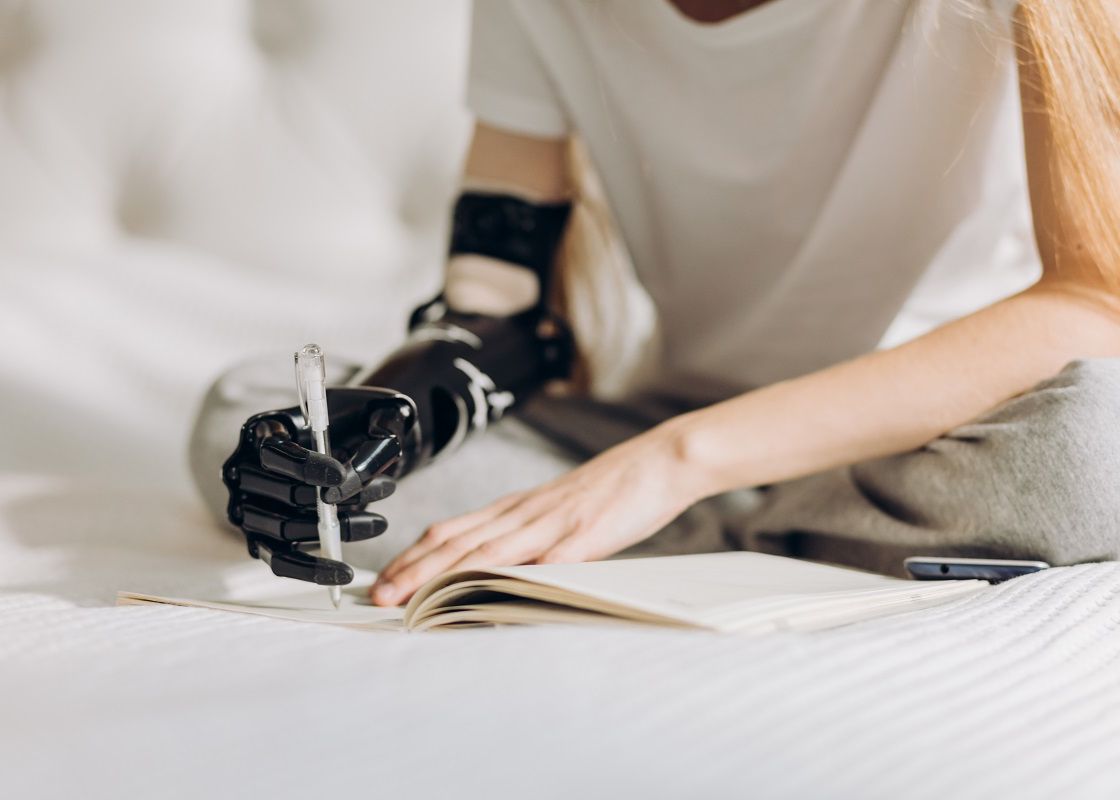 Brațul bionic inovator care le va schimba viața pacienților cu membre amputate Bratul Bionic Inovator Care Le Va Schimba Viata Pacientilor Cu Membre Amputate