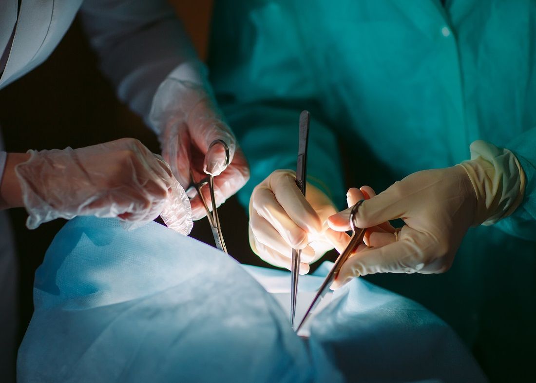 Premieră medicală uriașă. Un rinichi al unui porc, transplantat cu succes la un pacient uman Premiera Medicala Uriasa Un Rinichi Al Unui Porc Transplantat Cu Succes La Un Pacient Uman