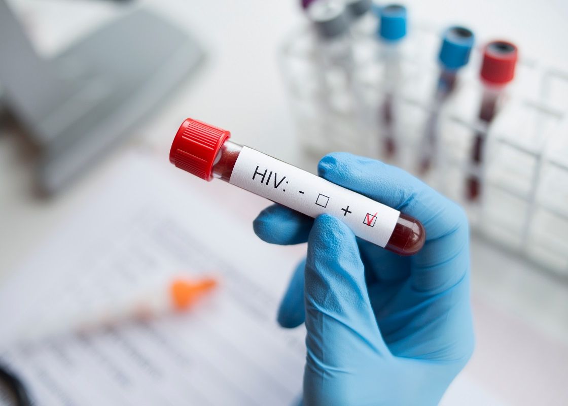 Caz extrem de rar. Medicii au descoperit a doua persoană din istorie care s-a vindecat natural de HIV Caz Extrem De Rar Medicii Au Descoperit A Doua Persoana Din Istorie Care S A Vindecat De Hiv