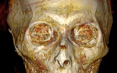 Imaginea Unui Faraon Egiptean Mort In Urma Cu 3 500 De Ani Reprodusa Digital Printr O Tehnica Revolutionara