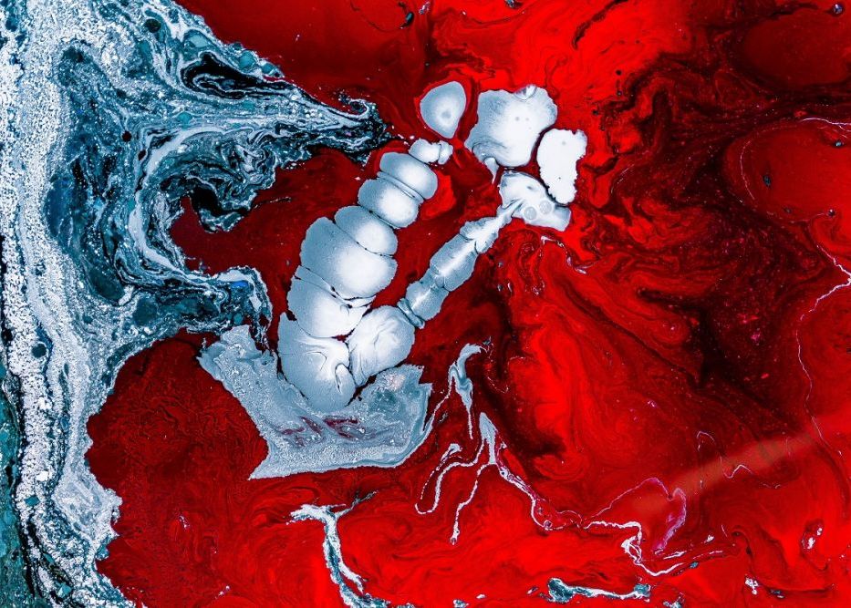 Studiu revoluționar. Un virus experimental care distruge celulele canceroase a fost injectat primului pacient Studiu Revolutionar Un Virus Experimental Care Distruge Celulele Canceroase A Fost Injectat Primului Pacient