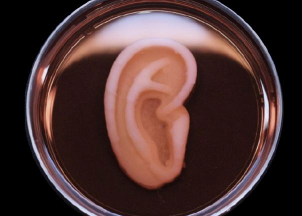 Medicii au transplantat cu succes prin ureche umană obținută prin imprimare 3D Medicii Au Transplantat Cu Succes Prin Ureche Umana Obtinuta Prin Imprimare 3d