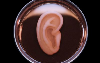 Medicii au transplantat cu succes prin ureche umană obținută prin imprimare 3D