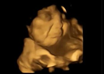 Bebelusii Nenascuti Reactioneaza La Gustul Alimentelor Consumate De Mama Dovada Amuzanta Gasita De Medici