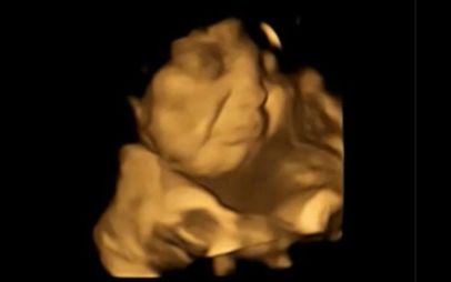 Bebelusii Nenascuti Reactioneaza La Gustul Alimentelor Consumate De Mama Dovada Amuzanta Gasita De Medici