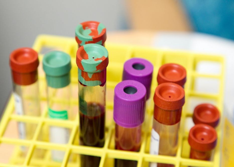 Descoperirea Unei Noi Grupe Rare De Sange Ar Putea Salva Vietile Multor Nou Nascuti