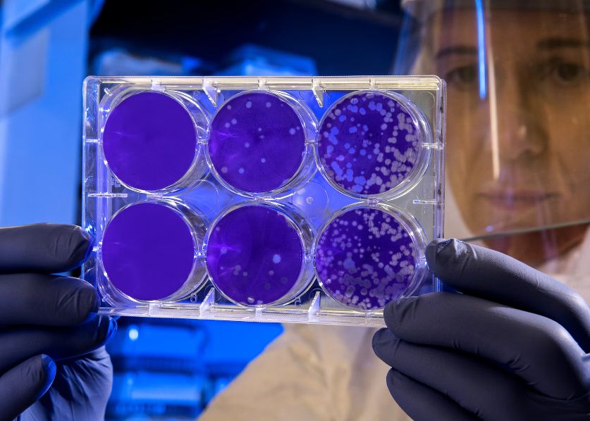 Model Matematic Intrigant Gasit In Celulele Corpului Uman