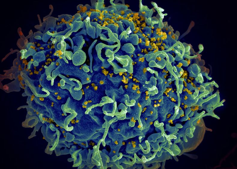 Cum Am Putea Pune Capat Epidemiei De Sida In Mai Putin De Un Deceniu