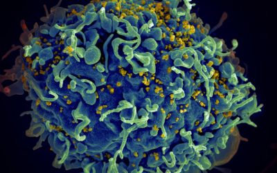 Cum am putea pune capăt epidemiei de SIDA în mai puțin de un deceniu