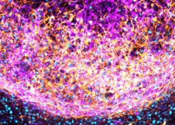 Cercetatorii Au Fabricat Un Zcreier In Miniatura Din Tesut Real Are Un Potential Urias