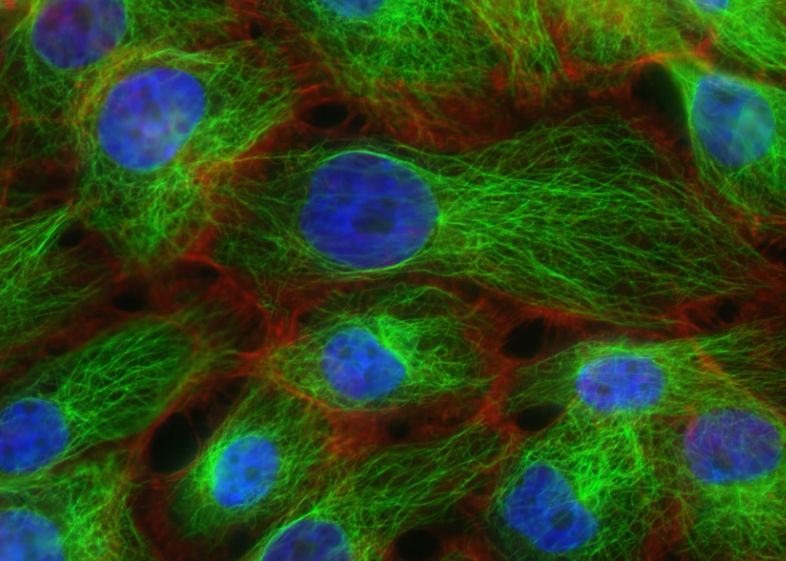 Expertii Mit Dezvolta Modele De Inteligenta Artificiala Care Pot Detecta Precoce Cancerul Pancreatic