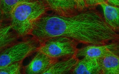 Experții MIT dezvoltă modele de inteligență artificială care pot detecta precoce cancerul pancreatic