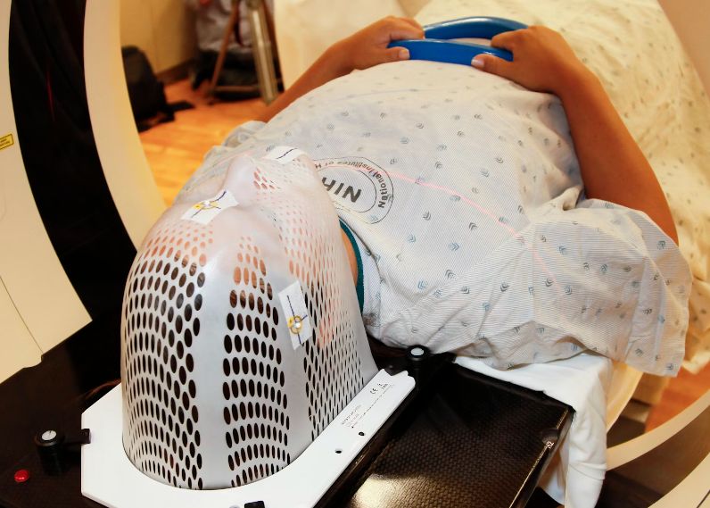 Compania Neuralink A Lui Elon Musk Ar Fi Implantat Deja Primul Cip In Creierul Unui Om